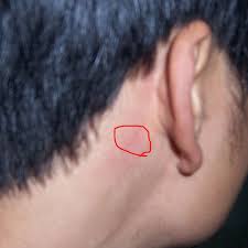 耳后.jpg